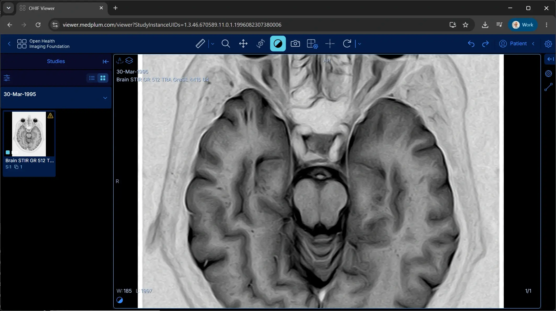 An MR brain study stored in Medplum, displayed in the OHIF Viewer at viewer.medplum.com