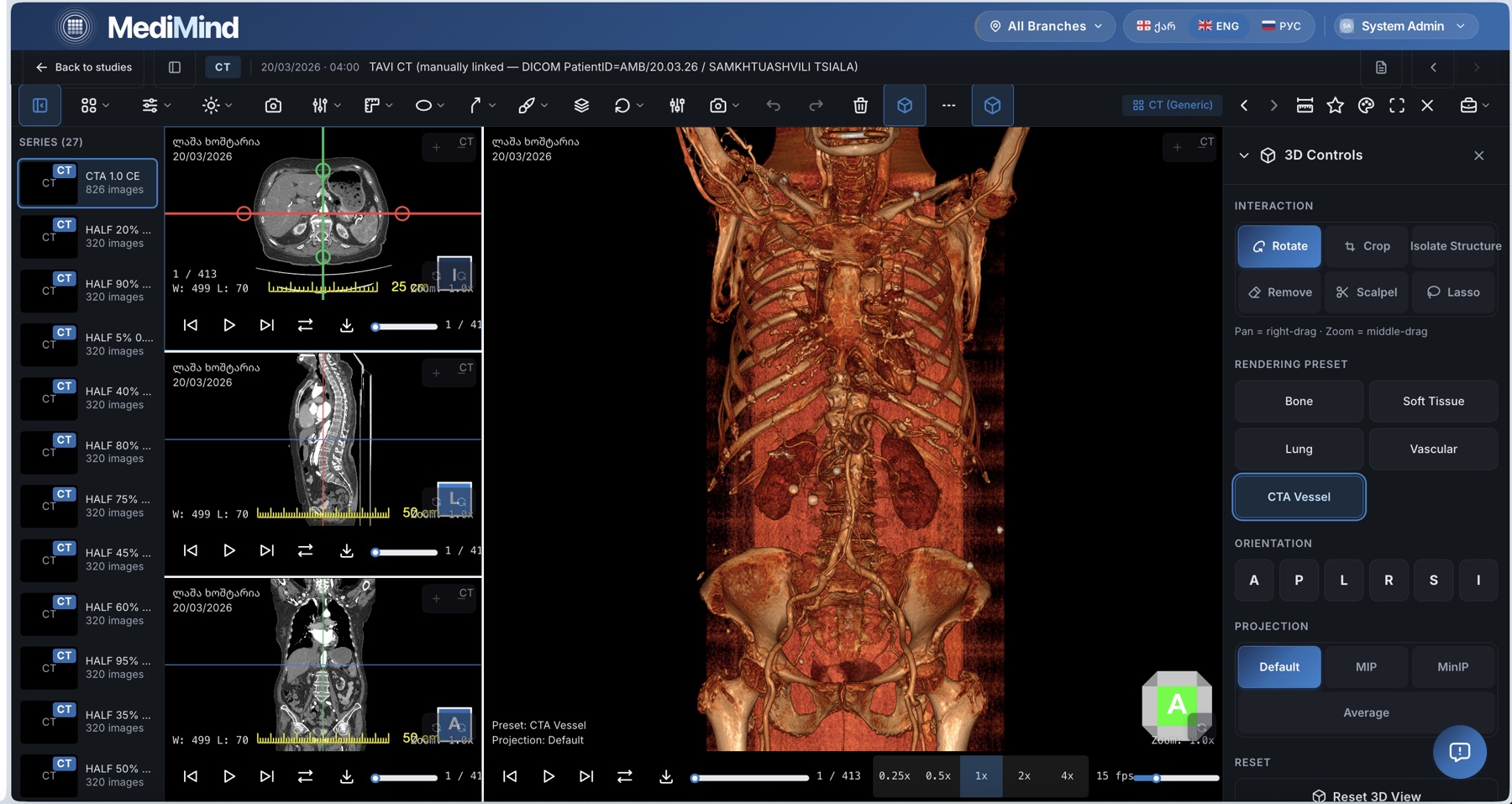 Figure 3: Imaging viewer, CT study.